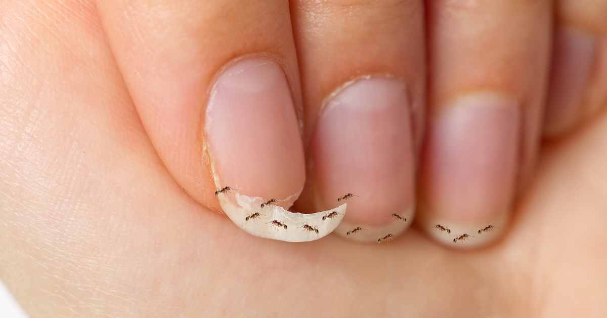 Do Ants Eat Fingernails?